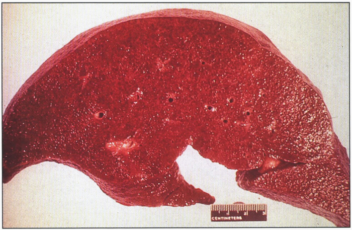 Fig.12