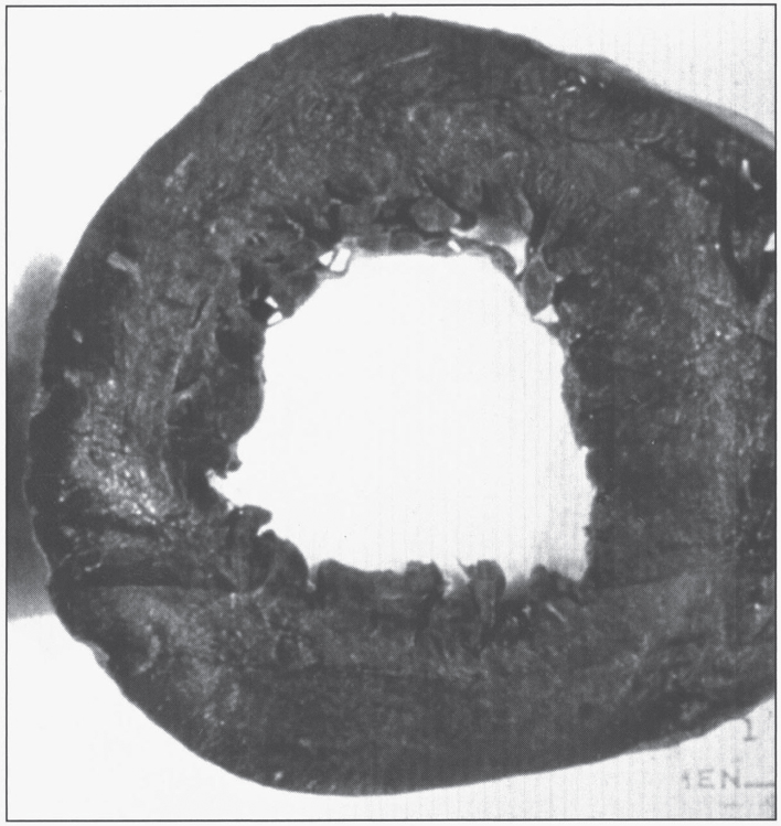 Fig.15