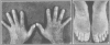 146