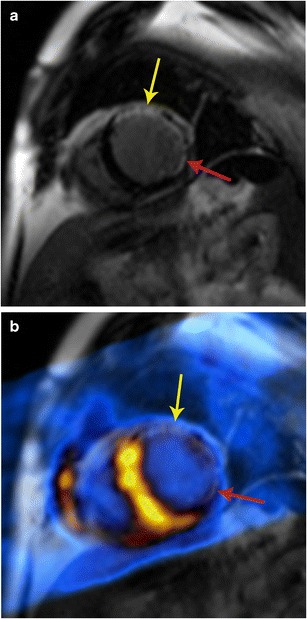 Fig. 18