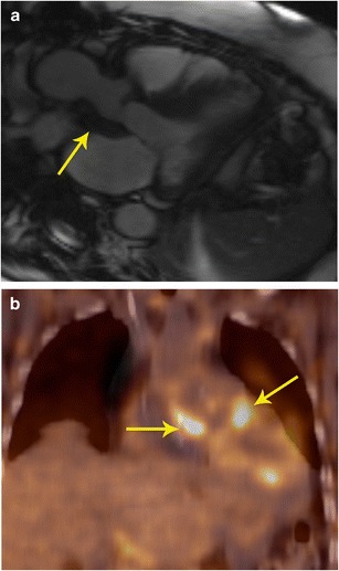 Fig. 15