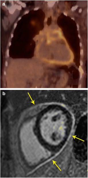 Fig. 14