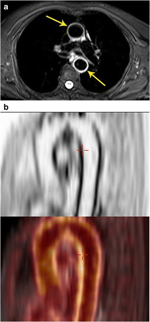 Fig. 16