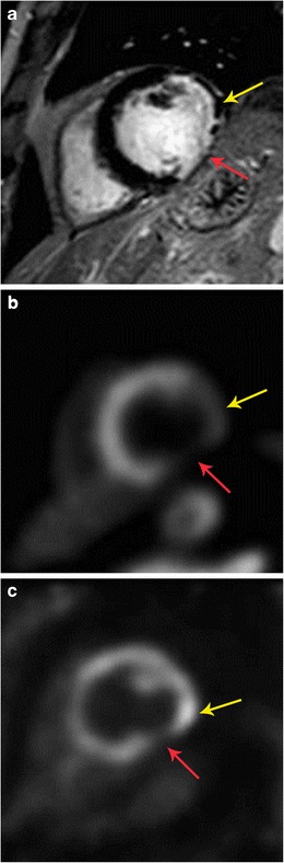 Fig. 19