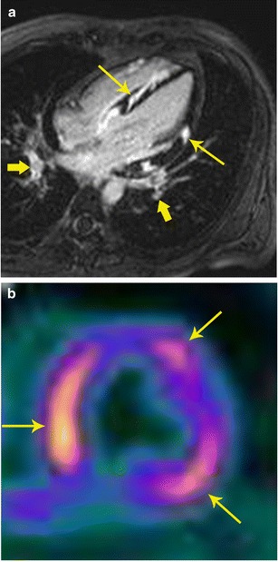 Fig. 12