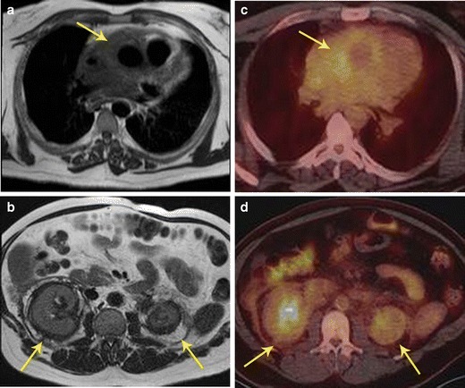 Fig. 13