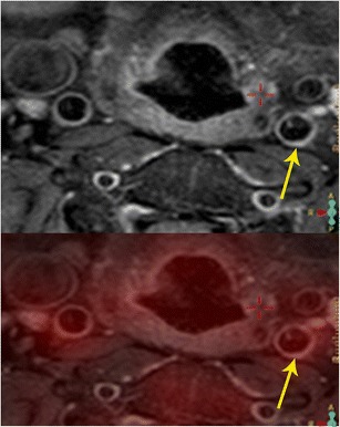 Fig. 17