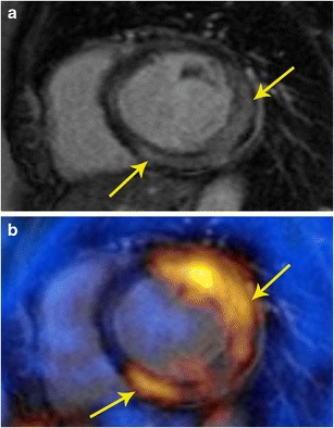 Fig. 11