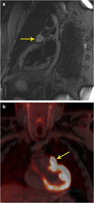 Fig. 10