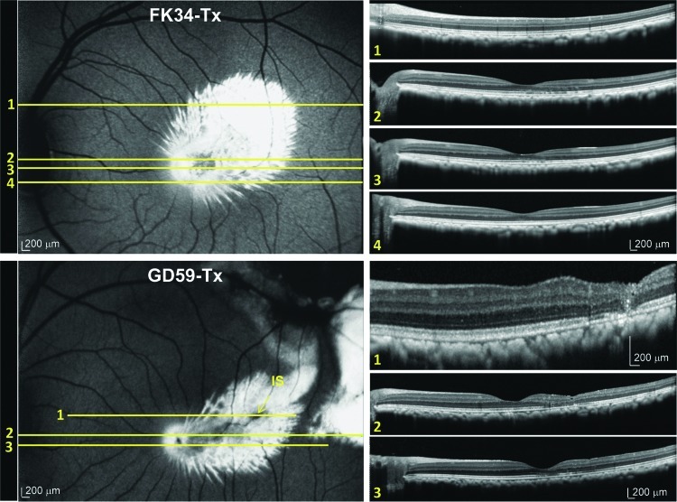 FIG. 4.