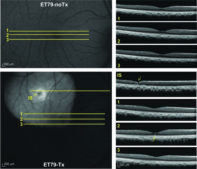 FIG. 3.