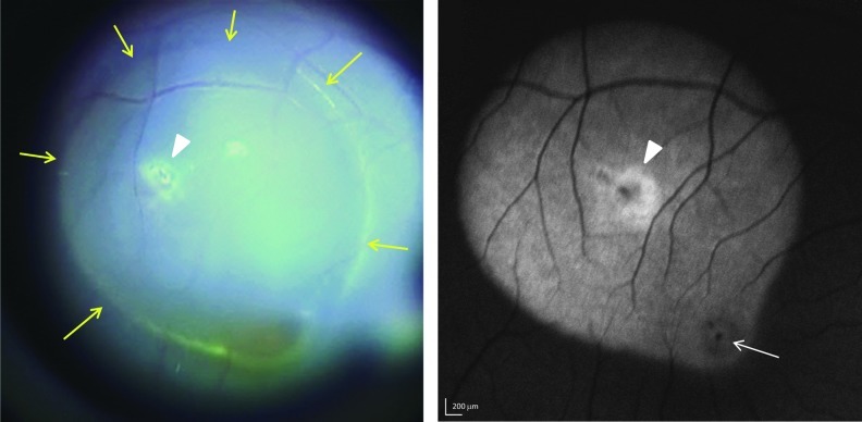 FIG. 2.