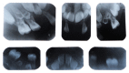 Figure 18