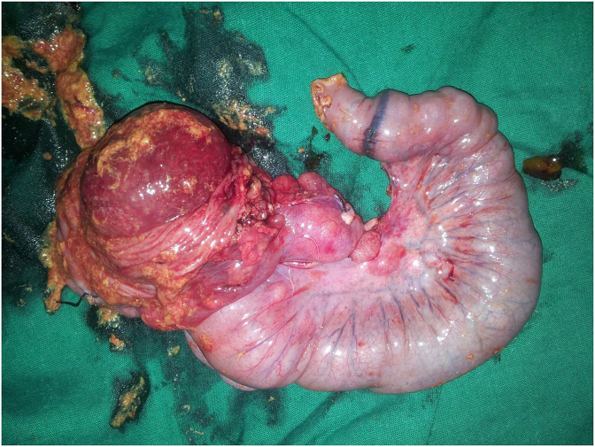 Fig. 1