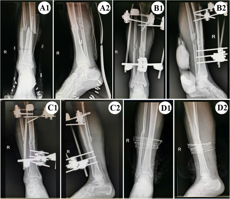 Fig. 2