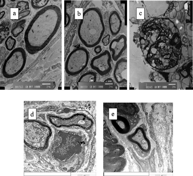 Fig. 11