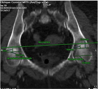 FIGURE 3