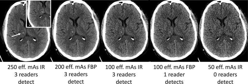 Fig 2.