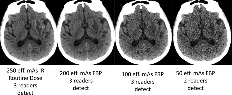 Fig 3.