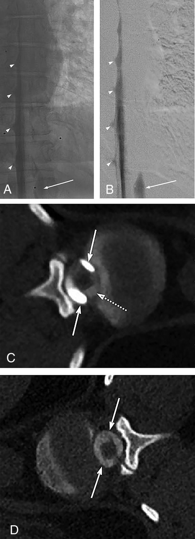 FIG 2.