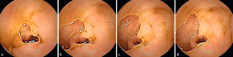 Fig. 1 a – d