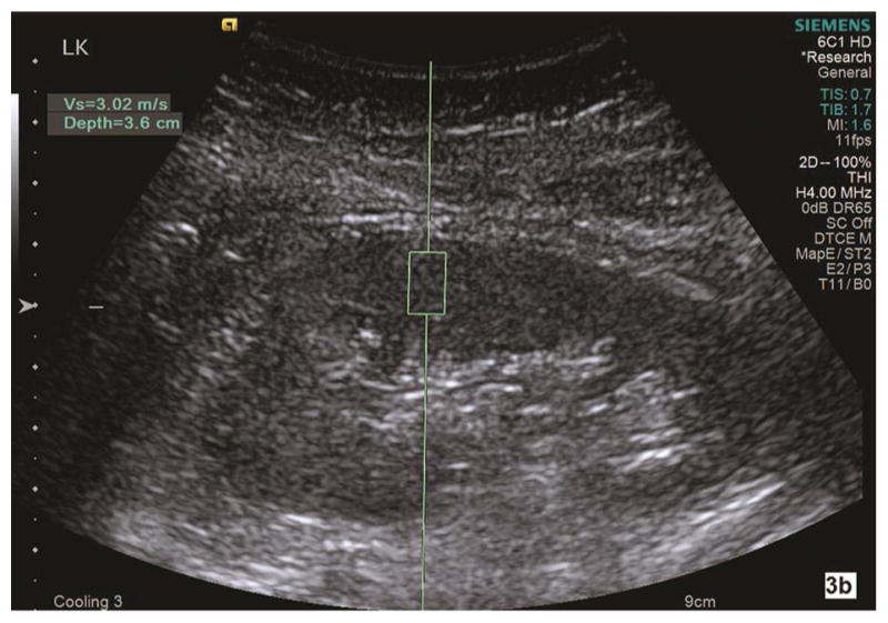 Fig. 3a–b