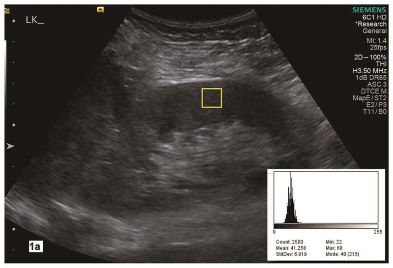 Fig. 1a–b