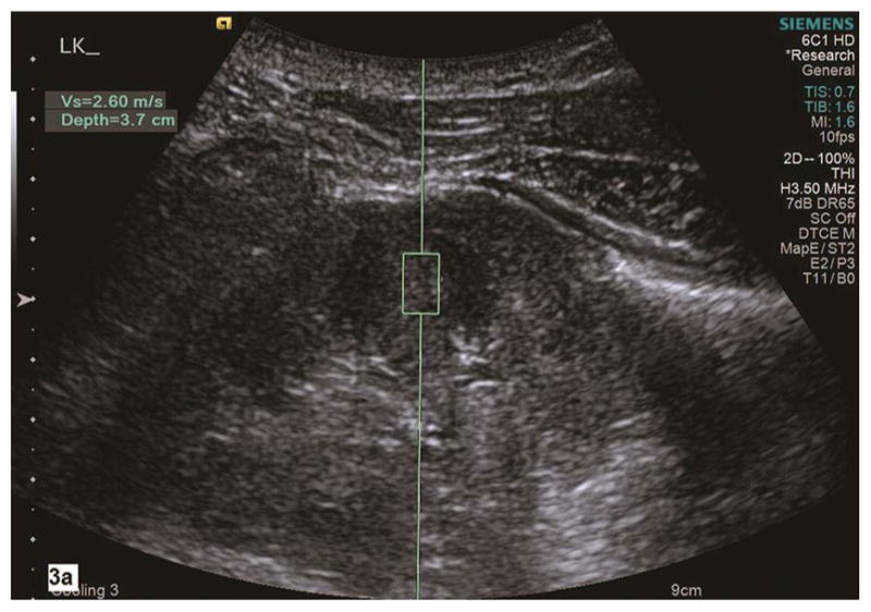 Fig. 3a–b