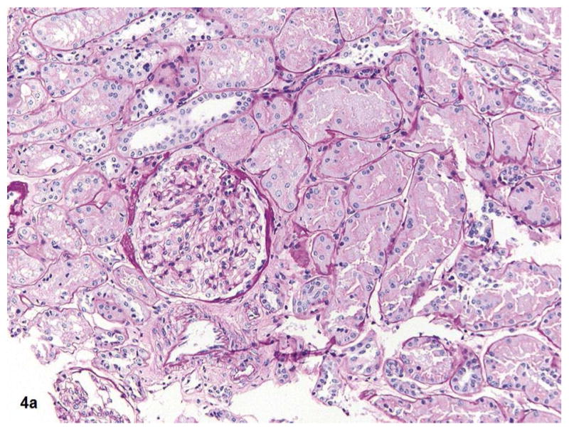 Fig. 4a–b