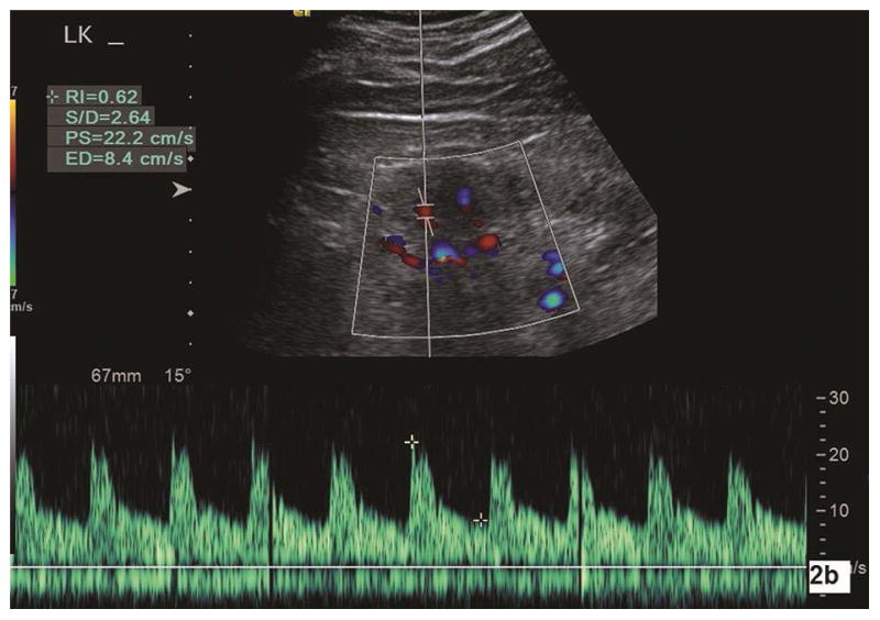 Fig. 2a–b