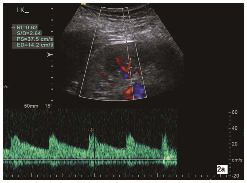 Fig. 2a–b