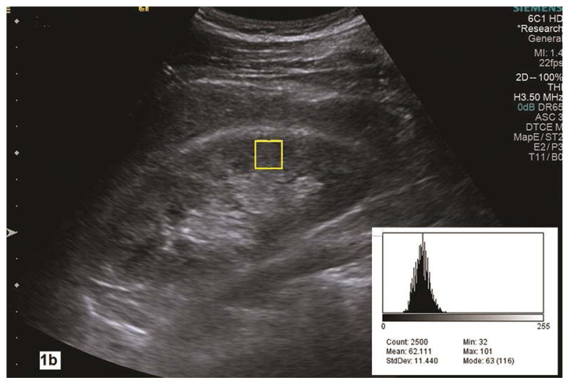 Fig. 1a–b