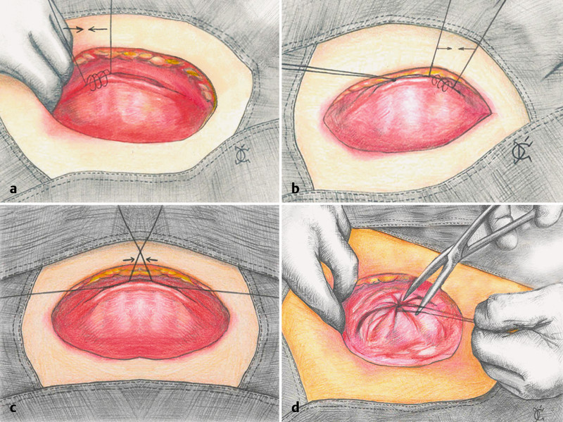 Fig. 2 a