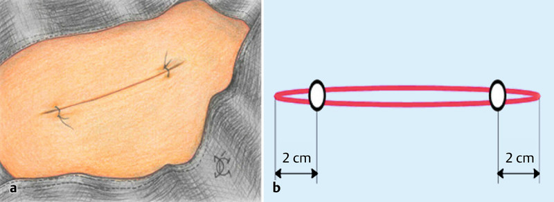 Fig. 3 a