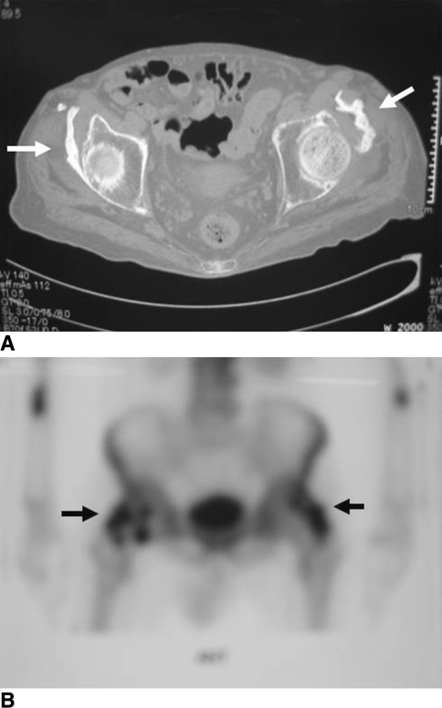 Fig. 2A–B