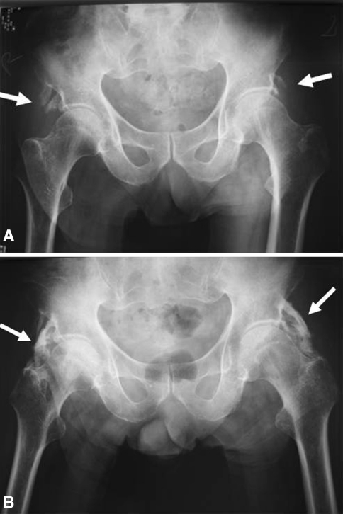 Fig. 1A–B