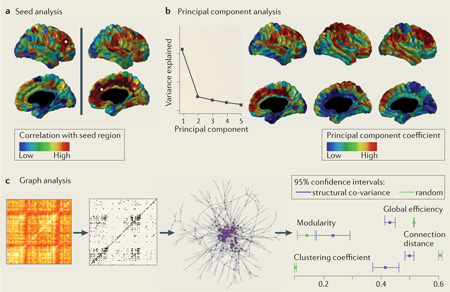 Box 2 | Structural co-variance networks