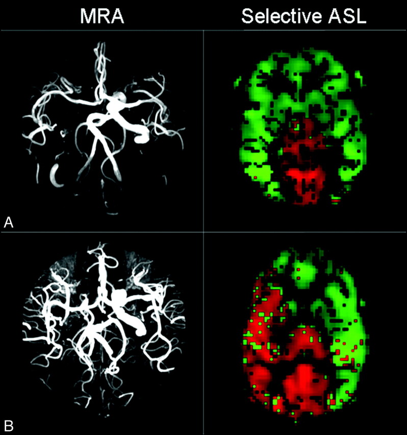 Fig 3.