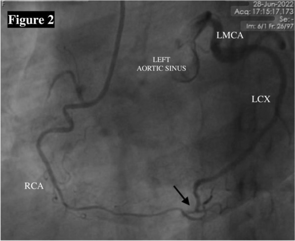 Fig. 2