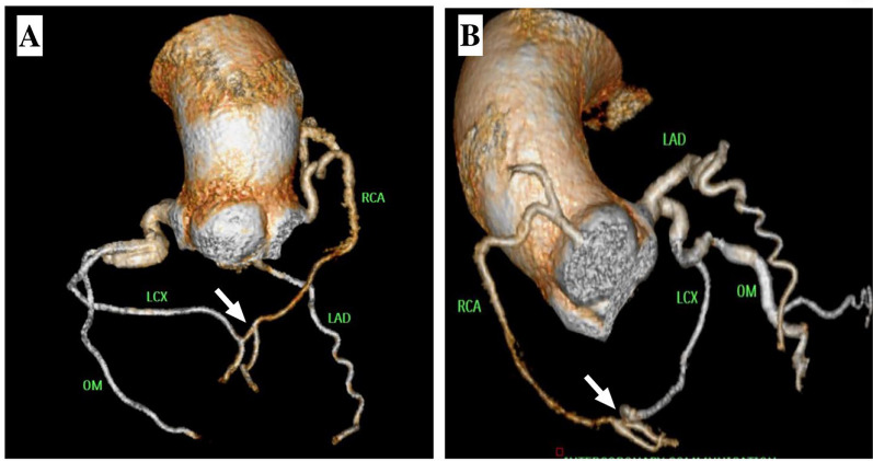 Fig. 3