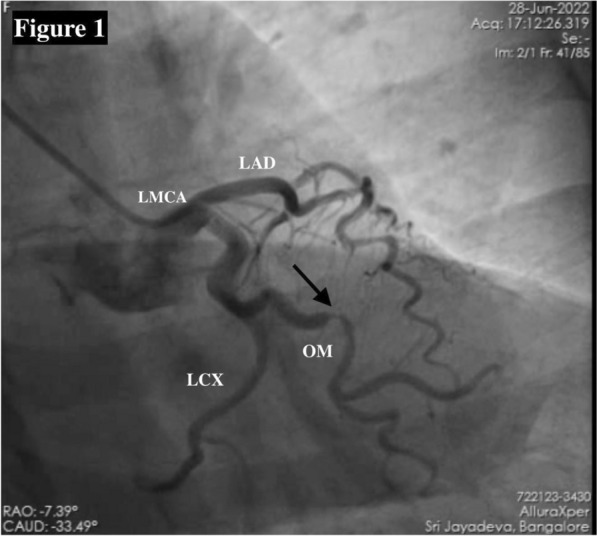 Fig. 1