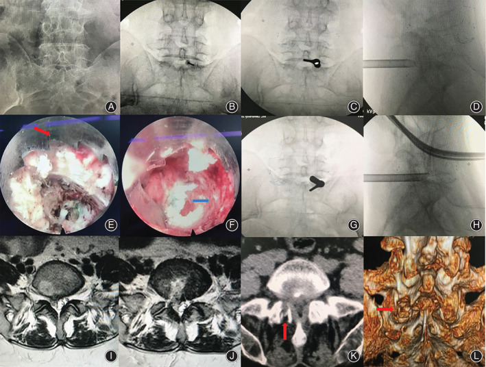 Fig. 6