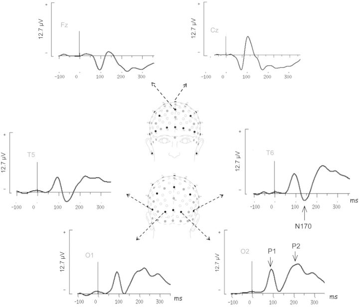 Fig. 2