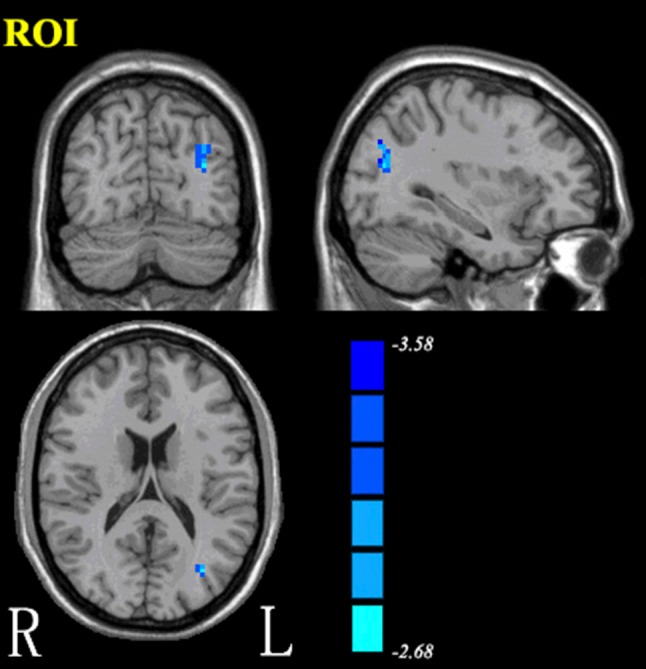 Fig. 1