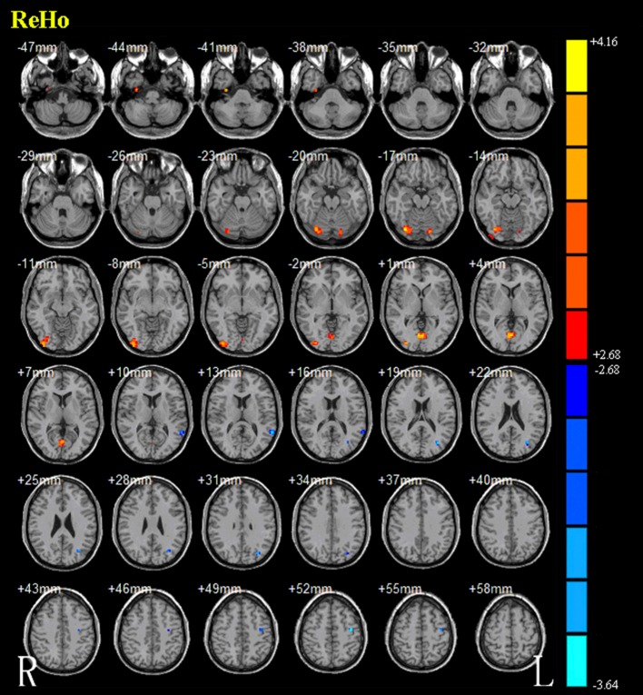 Fig. 2