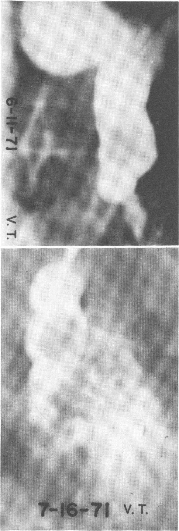 Fig. 1 and 2.