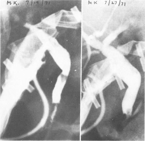 Fig. 7 and 8.