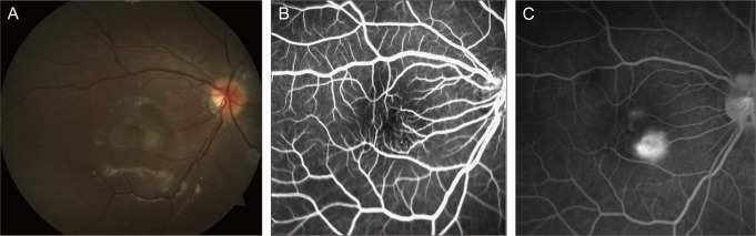 Fig. 1