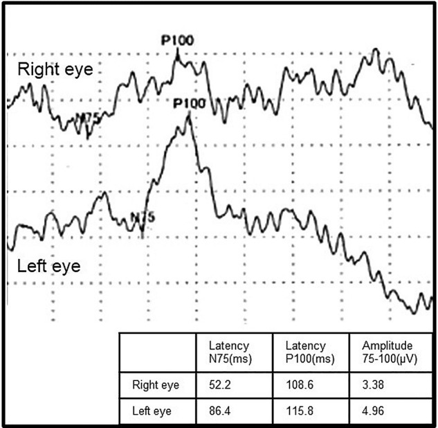 Figure 3