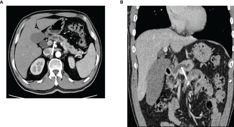 Figure 4